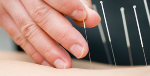 Points Of Health Acupuncture