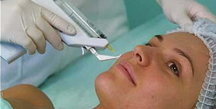 Cosmetology Laser-Washington-Mens Hair Removal