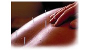 Acupuncture Healing Arts