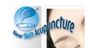 Nu Life Acupuncture