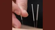 Lincoln Square Acupuncture