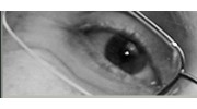 Thompson Lane Eye Care