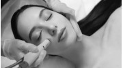 Acne Facials