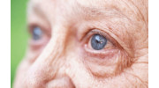 Macular Degeneration