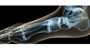 X-Ray