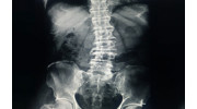 X-Rays