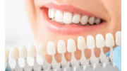 Dental Crowns