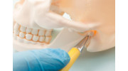 TMJ Treatment