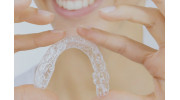 Clear Aligners - Invisalign