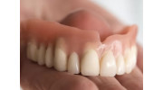 Dental Dentures
