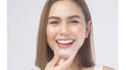 Invisalign