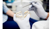 Dental Bridges
