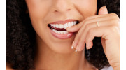 Teeth Whitening