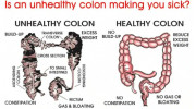 Colon Hydrotherapy