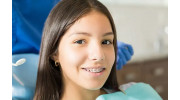 Metal Braces