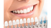 Teeth Whitening in Laguna Hills, CA