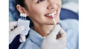 Teeth Whitening in Beverly Hills, CA