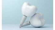 Dental Implants Restoration in Beverly Hills, CA