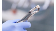 Teeth Extraction