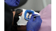 ZOOM! Teeth Whitening