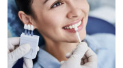 Dental Veneers and Laminates