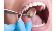 Teeth Cleaning (Prophy)