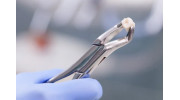 Tooth Extraction