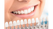 Teeth Whitening