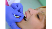 Porcelain Veneers