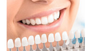 Teeth Whitening