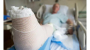 Broken Bones