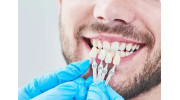 Porcelain Veneers