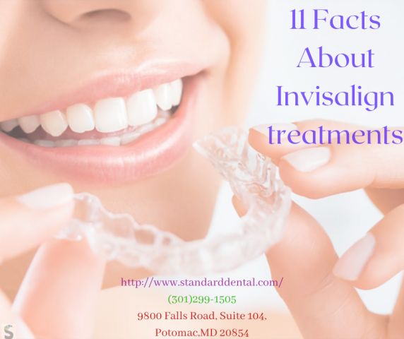 11 Facts about Invisalign Treatment